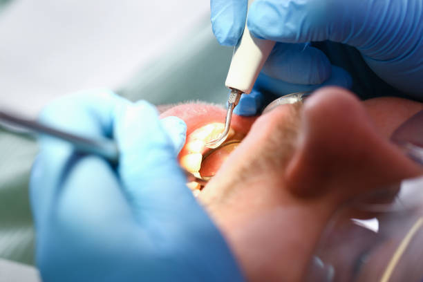 Best Walk-In Emergency Dentist in Reese, MI