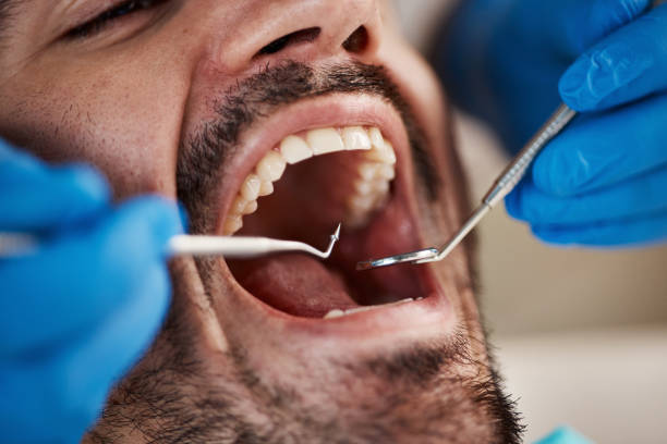 Best Walk-In Emergency Dentist in Reese, MI