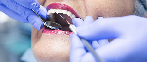 Best Emergency Broken Tooth Repair in Reese, MI